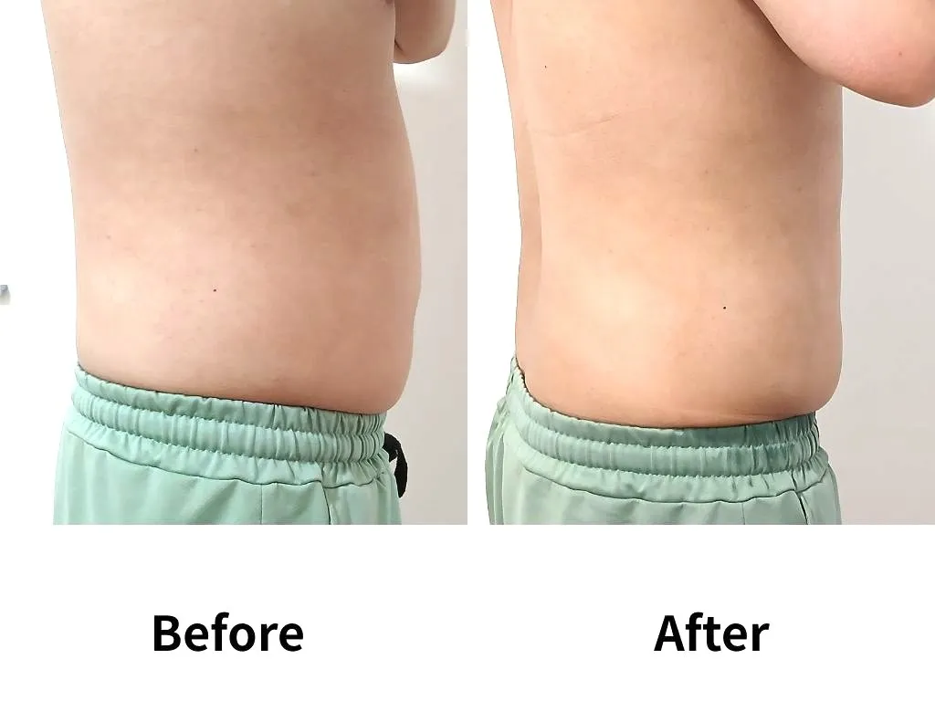 即日痩せセット30分