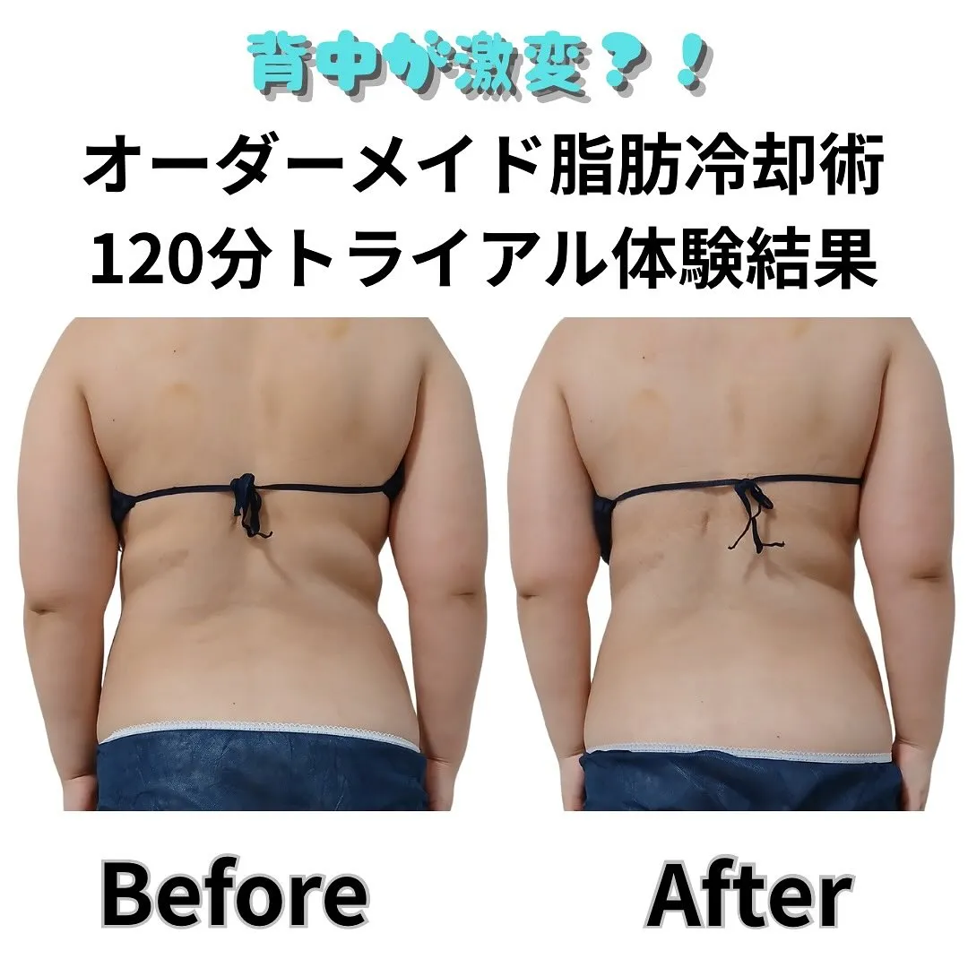 お腹周り・背中・二の腕が気になるお客様。