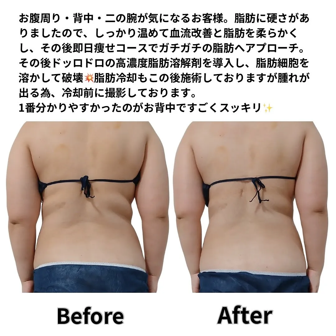 お腹周り・背中・二の腕が気になるお客様。