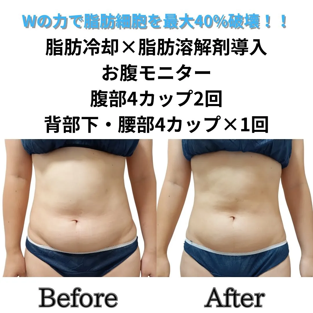 30代女性のお客様。