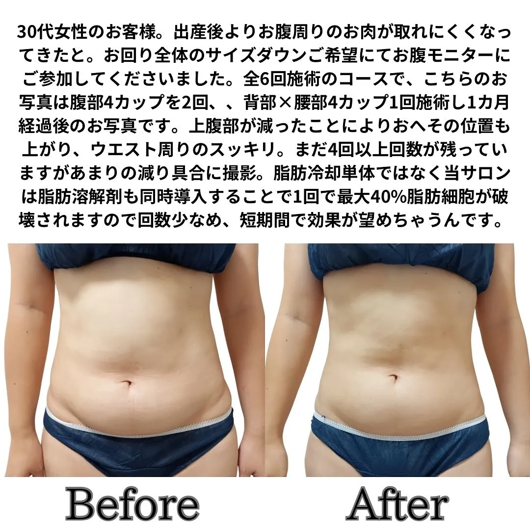 30代女性のお客様。