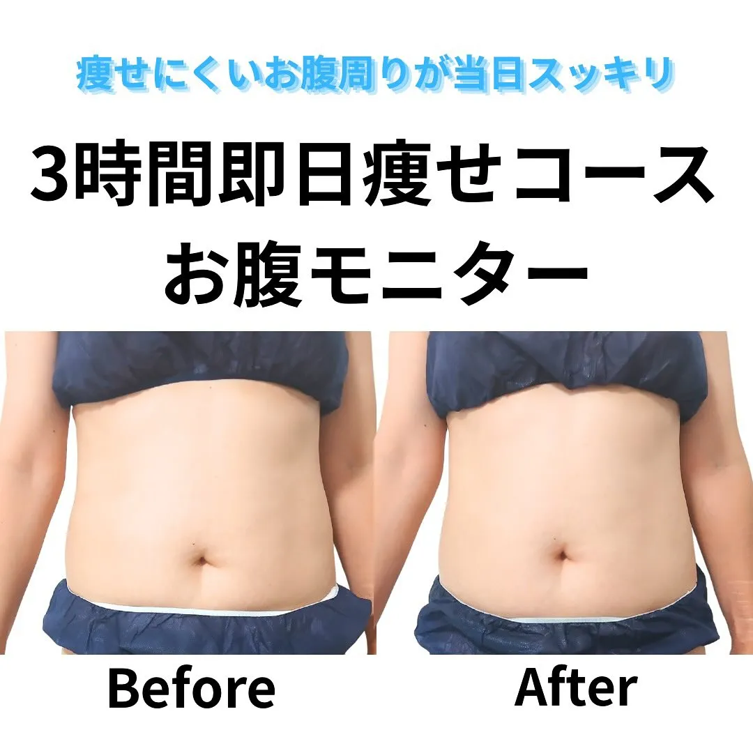前回即日痩せセット60分＋脂肪冷却8カップをされたお客様。