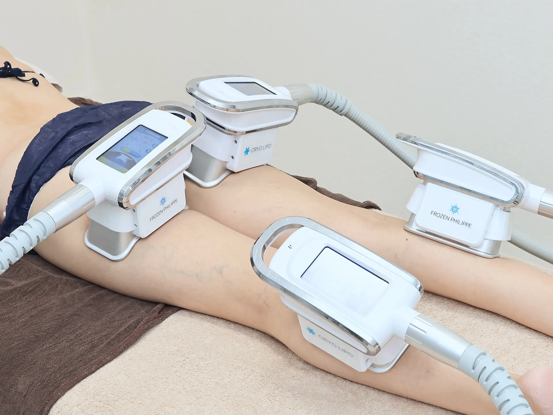 脂肪冷却施術例【背面足4カップ】