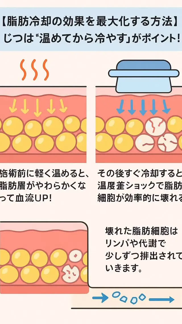 \脂肪冷却の効果をもっと高めたい方へ✨/